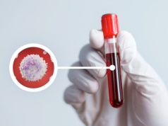 WBC w morfologii – co oznacza i jak interpretować wyniki? O czym świadczy obniżony lub podwyższony poziom?