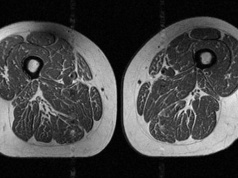 Ludzkie udo jak stek. Tak zmienia nas popularna żywność