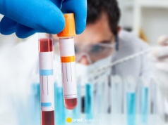 Jedna grupa krwi zwiększa ryzyko udaru. Naukowcy wciąż nie znają odpowiedzi