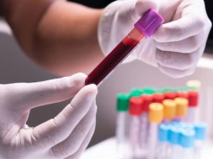 Nowe leki na białaczkę i chłoniaki w Polsce. Ministerstwo Zdrowia zapowiada możliwe decyzje refundacyjne