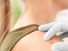 AI zmienia diagnostykę raka skóry. Czerniak pod kontrolą algorytmów