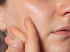 Zmniejsza widoczność porów jak laser. W aptece kosztuje kilka złotych