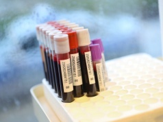 Krwiobus cały czas w trasie. Brakuje niemal wszystkich grup krwi