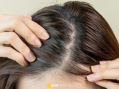 Ten szampon hamuje wypadanie włosów i pobudza cebulki. Rosną jak zaczarowane!