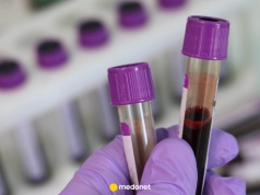 Nowe wytyczne na temat cholesterolu. To powinna wiedzieć każda osoba 30+