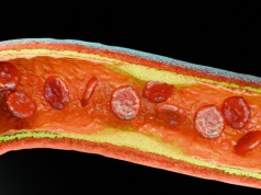 Cholesterol resztkowy – co to jest, jak go obliczyć i jak wpływa na zdrowie?