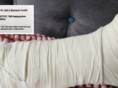 Złamał kostkę na parkingu. "Tyle dostałem z ubezpieczenia, kpina"