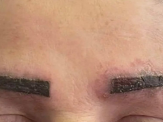 Popularny trend w makijażu wywołał u niej chorobę całego ciała. Lekarze ostrzegają