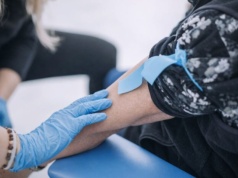 Badanie witaminy D w cenie 35 zł