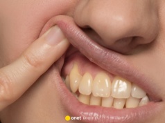 Od czego robią się żółte zęby? Higienistka stomatologiczna wyjaśnia