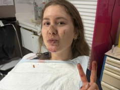 Kamilla Aasebø po wypadku z Paryż-Roubaix: „Pamiętam tylko 5 z 10 dni w szpitalu”