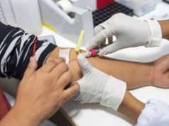 Płatny dzień wolnego dla pracowników. Lekarze chcą nakłonić do badań