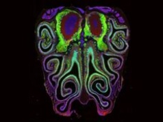 Wszyscy mają je w nosie. Naukowcy stworzyli ich mapę