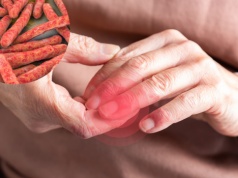 Gruźlica skóry: co to jest i jak się objawia? Przyczyny, diagnostyka i leczenie