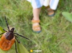 Jak prawidłowo usunąć kleszcza? Najczęstsze błędy i bezpieczne zasady postępowania.