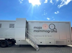 Bezpłatna mammografia wraca do Częstochowy. To badanie może uratować życie