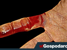 Skaleczenie? Zobacz w jaki sposób goją się rany