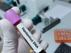 Nowe informacje w sprawie zakażeń hantawirusem i kolejne zakażenia. MSZ o Polakach na statku