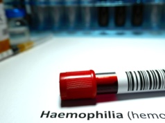 System leczenia hemofilii wymaga zmian. Eksperci: konieczne jest jak najszybsze zapewnienie dostępu do nowoczesnego leczenia