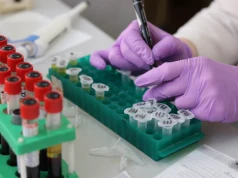 Naukowcy identyfikują biomarker oporności na chemioterapię w nawrotach raka