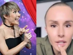 Chirurgiczna weteranka Blanka Lipińska chwali się NOWYMI USTAMI. "Nie każdy się tak świetnie goi jak ja". Zadrościcie? (FOTO)