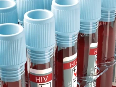 Liczba przypadków HIV bije rekordy. Czy Polacy są świadomi zagrożenia?