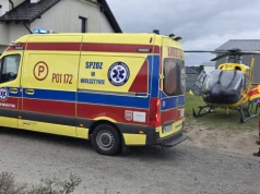 Półtoraroczne dziecko poparzone kawą. Lekarz mówi o jego stanie