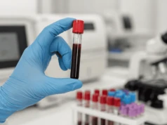 Lipoproteina(a) a ryzyko zawału i udaru – dlaczego warto badać marker Lp(a) we krwi?