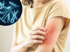 Helicobacter pylori – objawy skórne zakażenia. Z czym można je pomylić?