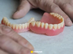 Ból dziąsła pod protezą zębową? Dentysta ostrzega: to nie jest normalne