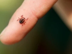 Naturalny sposób na kleszcze wraca do łask. Korzystały z niego nasze babcie