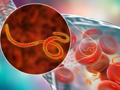 Epidemia Eboli, kilkadziesiąt zgonów. WHO: Globalny stan zagrożenia zdrowia publicznego
