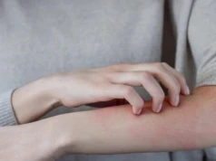 Alergia na wodę naprawdę istnieje. To wielka zagadka medycyny
