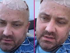 Adrian ze "ŚOPW" mówi o obrzęku mózgu. Takie ma objawy