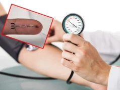 To jest elastyczny implant drukowany w technologii 3D, który w pierwszych testach wykazuje obiecujące wyniki w zakresie obniżania ciśnienia krwi