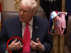 A jednak! Trump przejdzie badania, powraca temat tajemniczych siniaków. „Jestem znacznie młodszy niż senior”