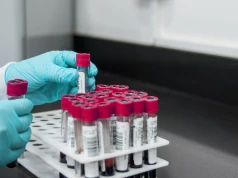 Test w kierunku HIV, HCV i kiły można wykonać bez skierowania, za darmo i anonimowo