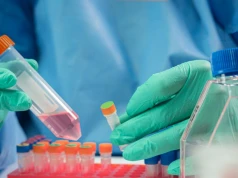 Ebola rozszerza się poza Afrykę? Podejrzenie u pacjenta w Brazylii