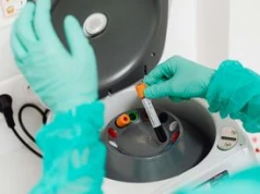 Bezpłatne badania laboratoryjne dla mieszkańców Małej Nieszawki. Ruszył program profilaktyczny