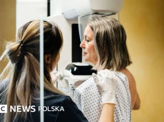 Nowe badanie: miliony osób z rakiem piersi mogą uniknąć chemioterapii