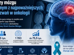 Guzy mózgu jednym z najpoważniejszych wyzwań w onkologii