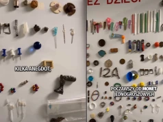 Monety, baterie, igły, słuchawki i klucz połknięty z miłości. Szpital pokazał, co musieli wyciągać z żołądków dzieci