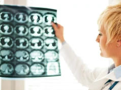 Otępienie dotyczy już setek tysięcy Polaków. Eksperci alarmują: system musi przyspieszyć