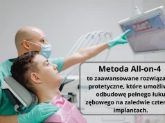 Na czym polega metoda All-on-4 i jakie są jej etapy