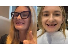 Gwiazda "Rolnik szuka żony" zrobiła sobie zęby w Turcji. Kolosalna metamorfoza