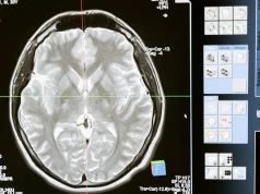 Wszczepiono pierwszy bezprzewodowy implant mózg-komputer. Ma przywrócić komunikację pacjentom
