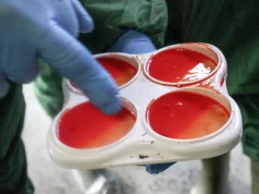 Zdrowie wymienia zaczyna się od analizy – jak skutecznie ograniczać mastitis na fermach mlecznych?