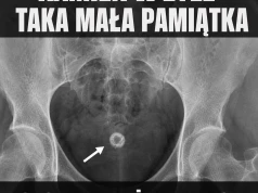 Biologia znowu zostawiła gruz w rurach