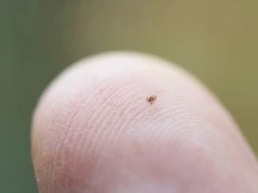 Nowy pieprzyk? Ostrożnie! To może być nimfa kleszcza. Zobacz, dlaczego nimfy kleszcza są groźniejsze od dorosłych kleszczy