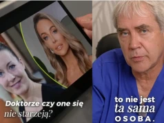 „To nie ta sama osoba”. Lekarz ocenił twarz Małgorzaty Rozenek po zabiegach
